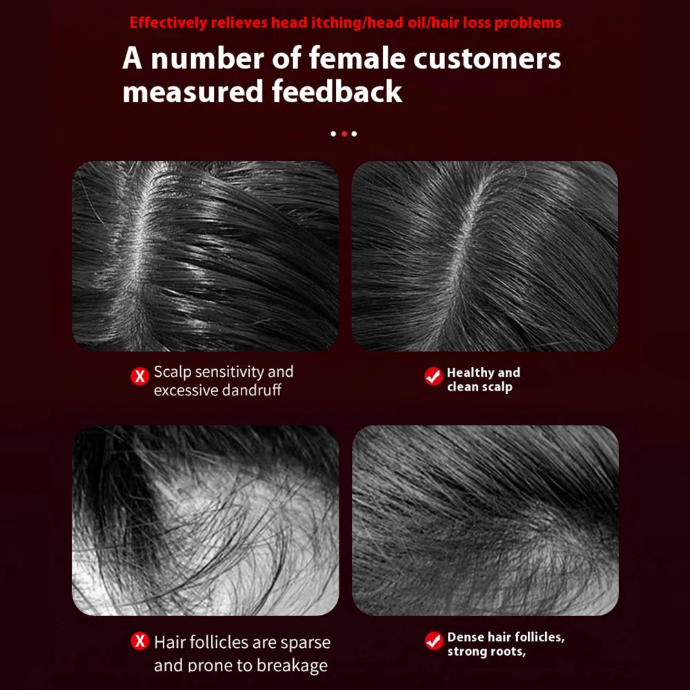 Red Light Therapy Hair Growth Scalp Massager