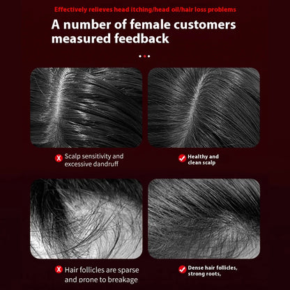 Red Light Therapy Hair Growth Scalp Massager